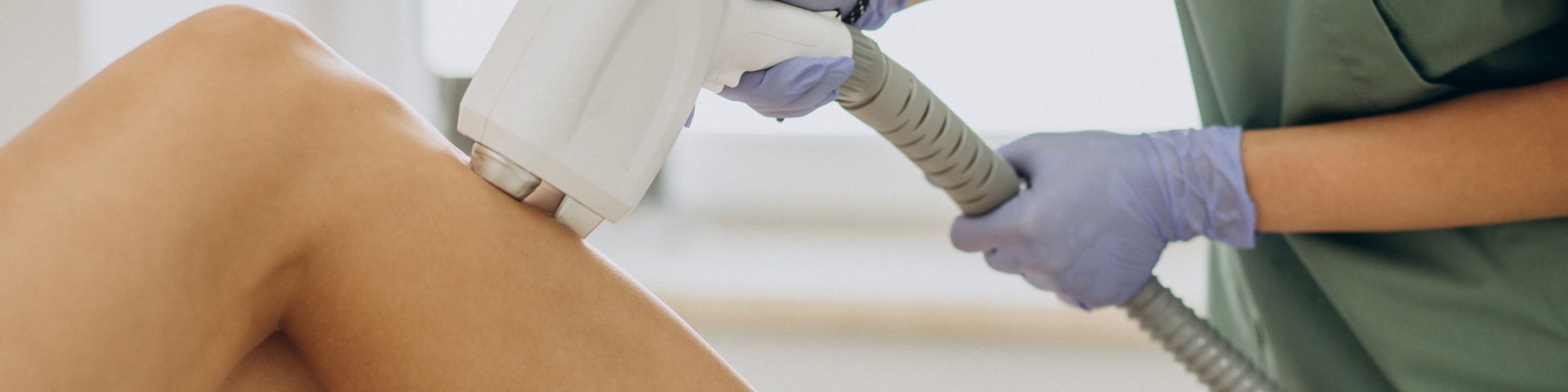 depilacion-laser-verano